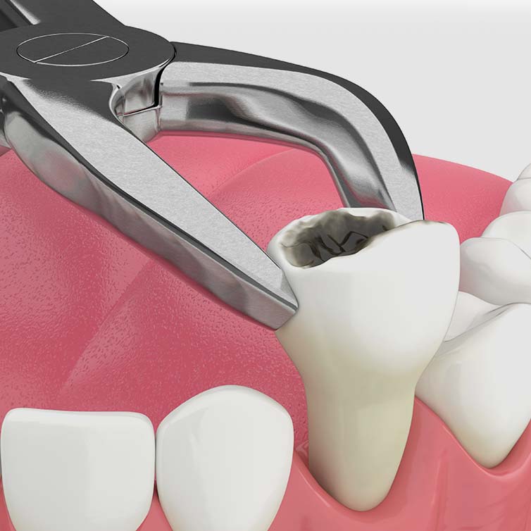 Treatment - Diamond Dental Care