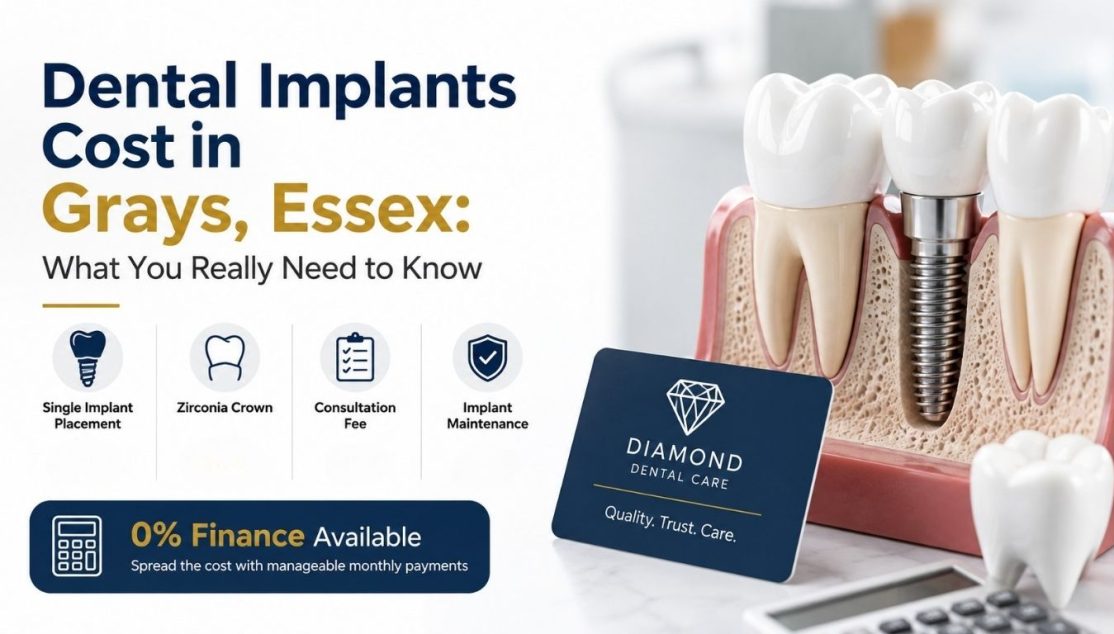 Dental implant cost