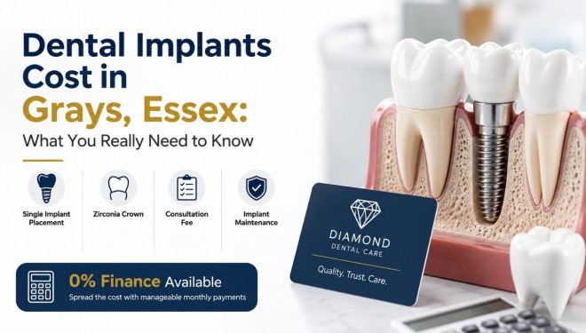 Dental implant cost
